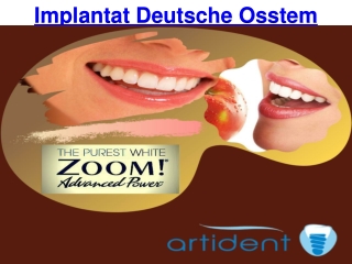 Implantat Deutsche Osstem