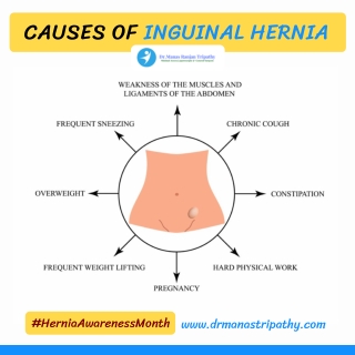 Inguinal Hernia Causes | Laparoscopic Hernia Treatment in Bangalore | Dr. Manas Tripathy