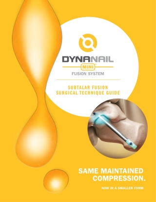DynaNail Mini® Fusion System – Subtalar Fusion Surgical Technique Guide