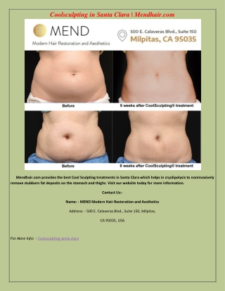 Coolsculpting in Santa Clara | Mendhair.com