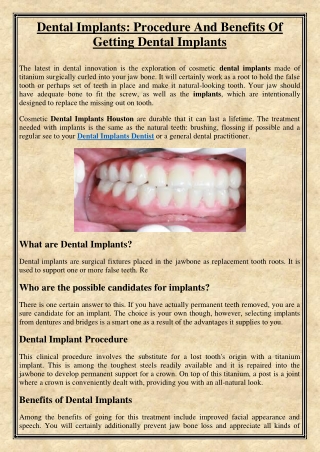 Dental Implants: Procedure And Benefits Of Getting Dental Implants