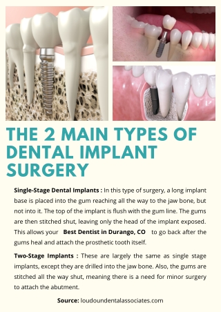 The 2 Main Types of Dental Implant Surgery