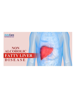 Non Alcoholic Fatty Liver Disease