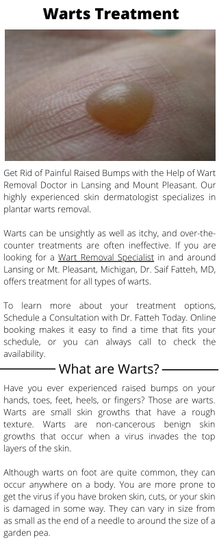 Wart Removal Specialist In Lansing and Mt. Pleasant