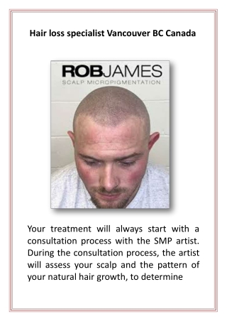 Hair loss specialist Vancouver BC Canada