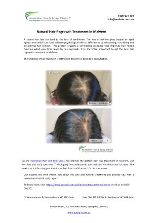Natural Hair Regrowth Treatment in Malvern