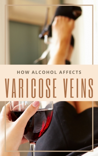 How Alcohol Contributes to Varicose Veins
