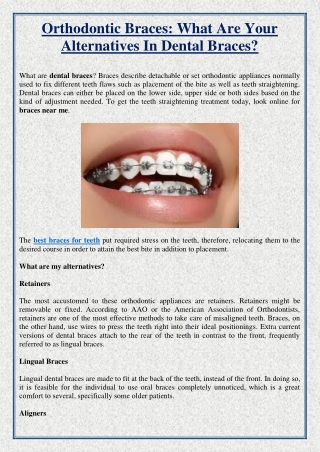 Orthodontic Braces: What Are Your Alternatives In Dental Braces?