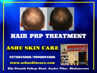 Ashu Skin Care - Best Hair Transplant Clinic in bhubaneswar Odisha  .