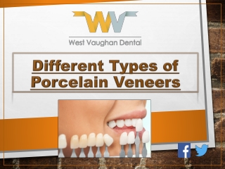 Different Types of Porcelain Veneers