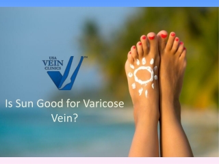 Is Sun Good for Varicose Veins?