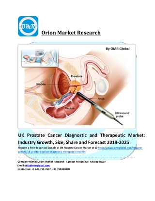 UK Prostate Cancer Market Share, Growth, Analysis and Forecast 2019-2025