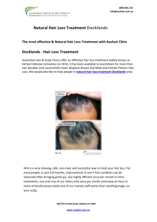 Natural Hair Loss Treatment Docklands