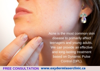 Acne Treatment